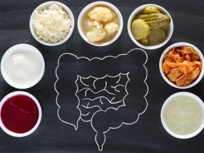 As fermented foods rise in popularity, here's what experts say