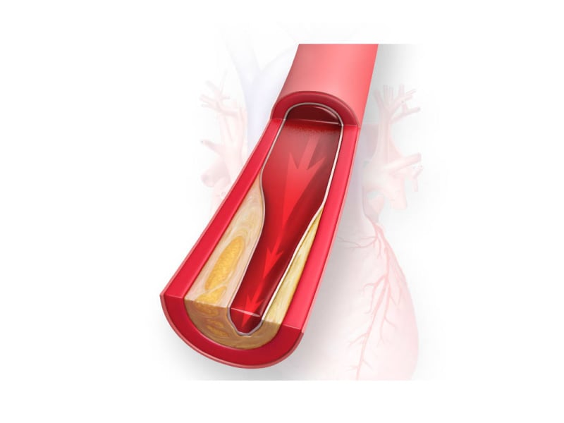Making sense of cholesterol – the good, the bad and the dietary