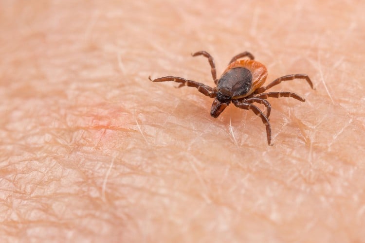 What Is Rocky Mountain Spotted Fever? CDC Issues Health Alert
