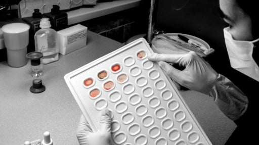 New blood test may be able to detect 18 cancers in early stages