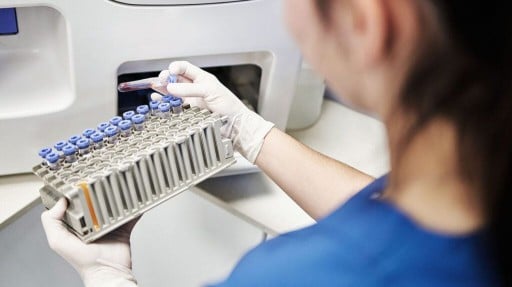 Obesity linked to potential risk of multiple myeloma blood cancer
