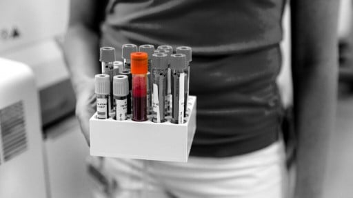 Can an Alzheimer&amp;#x27;s blood test help early diagnosis of the disease?