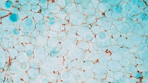 Obesity: How a single molecule may disrupt the body&rsquo;s metabolism